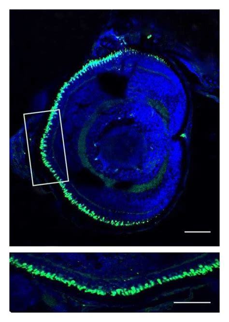 A Morphological Changes In Zebrafish Injected With Control