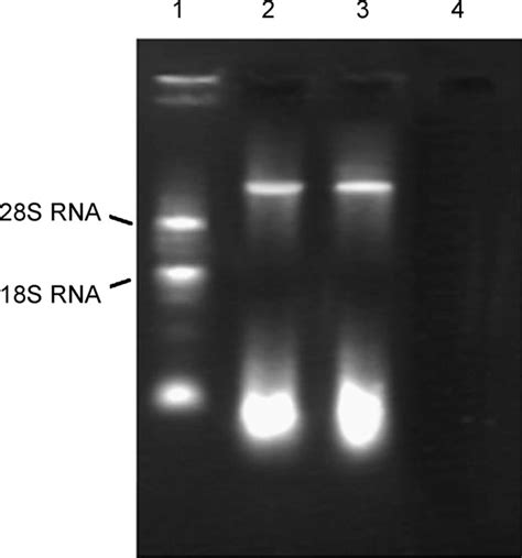 Denaturing Agarose Gel Electrophoresis Of Total Rna Of Lanzhou Lily Download Scientific Diagram