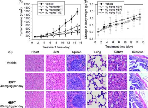 Antitumor Activity Of Hbpt In Vivo Mice With Established U87mg Tumor