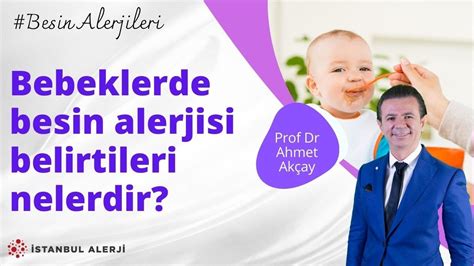 Bebeklerde besin alerjisi belirtileri nelerdir Prof Dr Ahmet Akçay