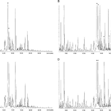 Typical Chromatogram Total Ion Current Of The 24 H Urine Sample Download Scientific Diagram