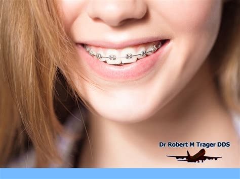 Braces Vs Clear Aligners Options For Teeth Straightening