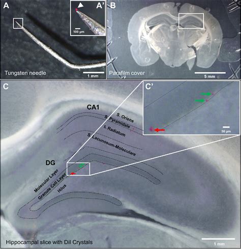 Figure 1 from Acute slice preparation for electrophysiology increases ... 