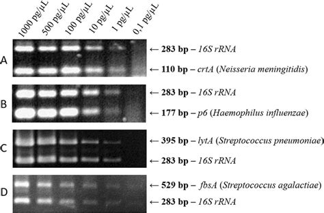 Sensitivity Test Of The Multiplex Pcr Performed With Serial Dilutions