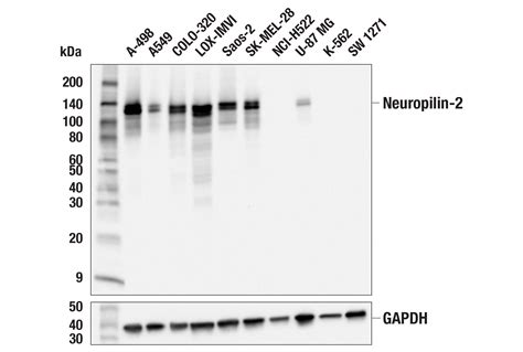 Neuropilin E Q G Rabbit Mab Cell Signaling Technology