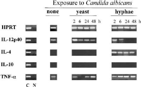 Figure From Dendritic Cells Discriminate Between Yeasts And Hyphae Of