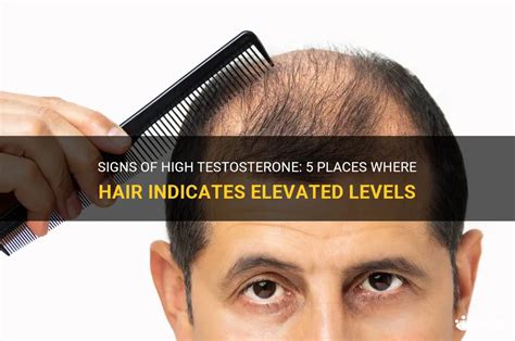 Signs Of High Testosterone 5 Places Where Hair Indicates Elevated