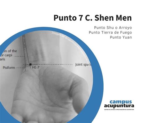 Punto C Shen Men Campus Acupuntura