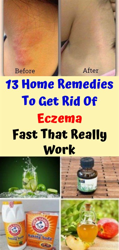 Let Start Slim Today 13 Home Remedies To Get Rid Of Eczema Fast That Really Work