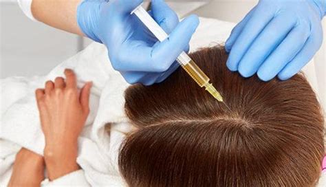 Everything You Need To Know About Stem Cell Therapy For Hair Baldness