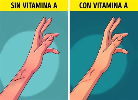 7 Señales que indican que existe una deficiencia de vitamina A en el