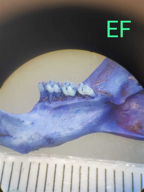 Top Periodontaldisease Datasets And Models Roboflow Universe