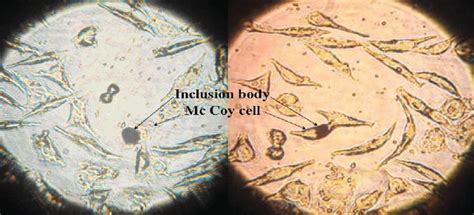 Chlamydia Stain