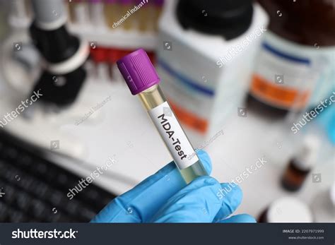 Urine Samples Testing Mda Laboratory Urine Stock Photo 2207971999