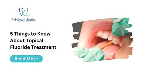 5 Things to Know About Topical Fluoride Treatment | Robstown Smiles