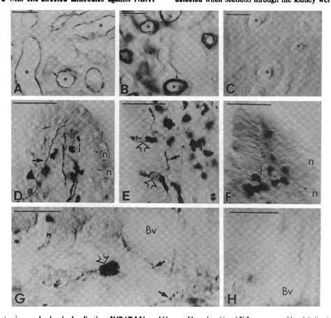 Figure 1 From Ultrastructural Localization Of A Neutral And Basic Amino