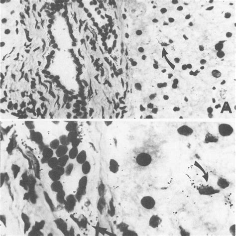 In Situ Hybridization With 35silabeled A 1 Iii Procollagen