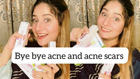 Say Goodbye To Acne And Scars Forever Ultimate Guide To Beating Acne