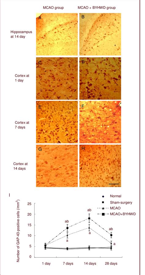 Effects Of Buyang Huanwu Decoction BYHWD On Expression Of Growth