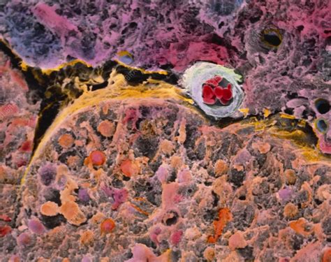 coloured sem  pars intermedia  pituitary gland stock image p