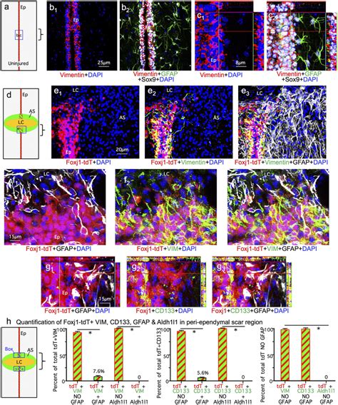 Comparison Of Sox9 Vimentin CD133 Foxj1 TdT GFAP And Aldh1l1 In The