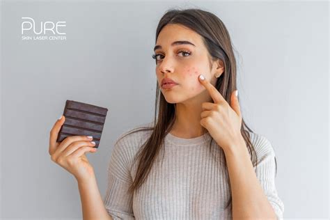 Debunking Common Myths About Acne And Food Pureskinlasercenter