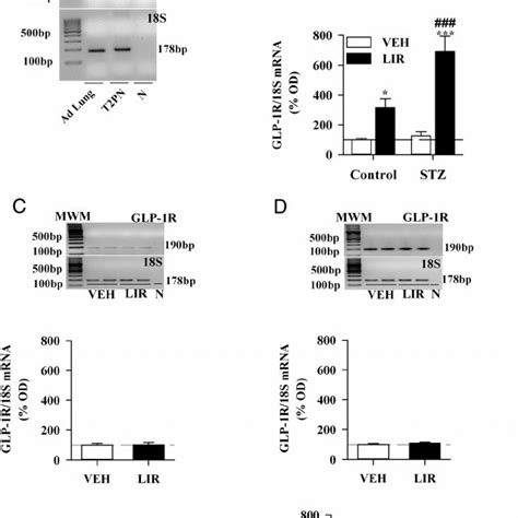 GLP 1R Expression In T2PN And The Effect Of LIR On GLP 1R Expression In