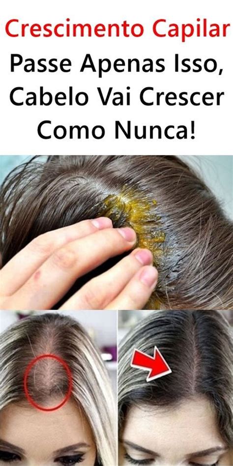 Passe Apenas Isso Cabelo Vai Crescer Como Nunca Cabelo Crescer Mais