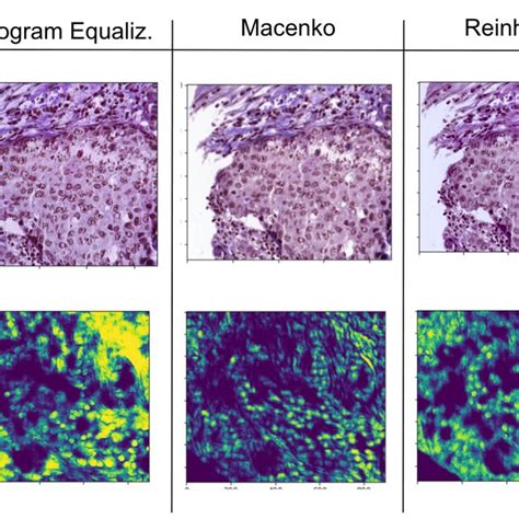 Comparison Of Different Stain Normalization Procedures On Model