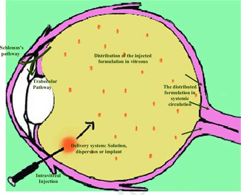 The General Way Of Intravitreal Injection Administration And Its