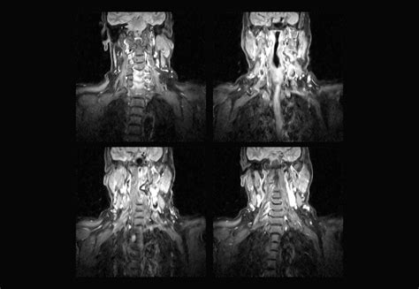 Premium Photo Cervical Spine Mri And Ct Scan Xray Images Professional