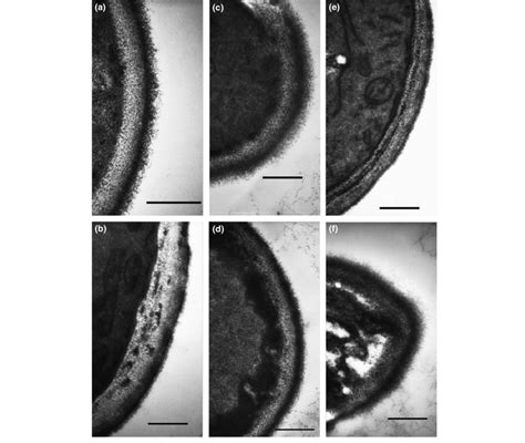 Transmission Electron Micrographs Of Candida Albicans Cell Walls Of