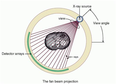 Computed Tomography Radiology Key