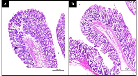 Histopathology Photomicrographs Of A Untreated Rectal Mucosa And B Download Scientific