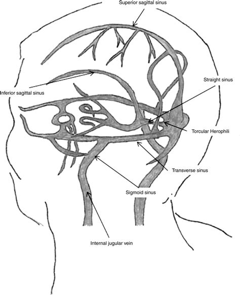 Cerebral Venous Sinus Thrombosis Journal Of Thrombosis And Haemostasis