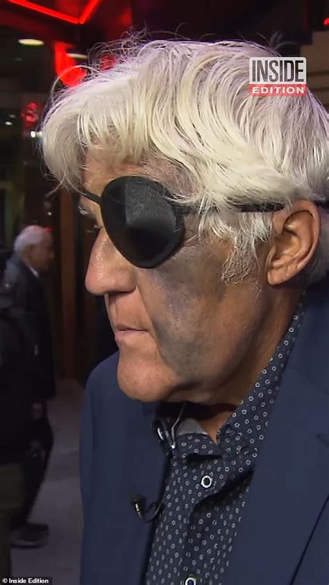 Jay Leno 74 Shows Heavily Bruised Face And Eye Patch From Shock Fall