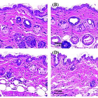 Micrographs Of Hematoxylin Eosin Stained Mice Skin Sections After The