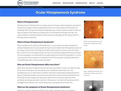 What Causes Histoplasmosis In The Eye - Infoupdate.org