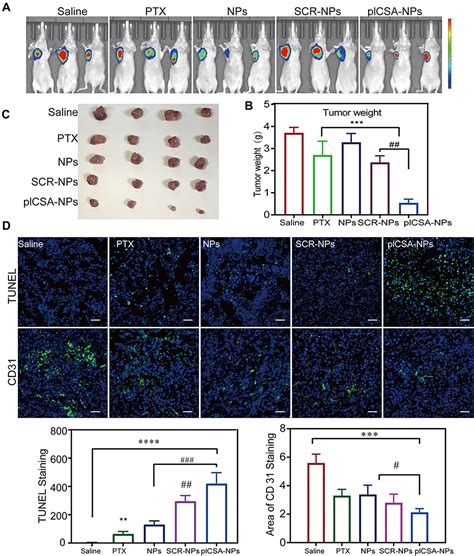 Chemotherapy For Breast Cancer And Lung Metastasis IJN