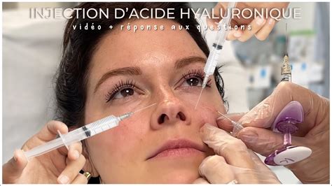 Injection Dacide Hyaluronique Je Vous Montre Tout Cernes Youtube