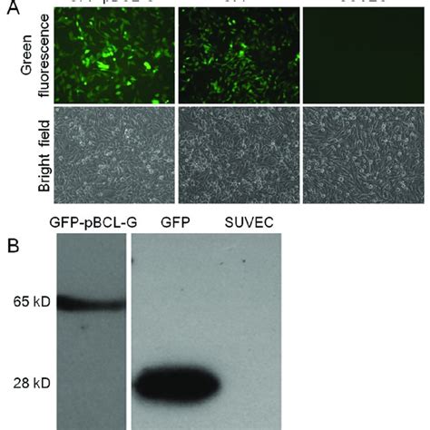 Detection Of The Expression And Subcellular Localization Of Gfp Fused