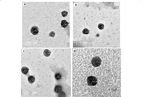 Transmission Electron Microscopic Tem Visualization Of Evs Isolated