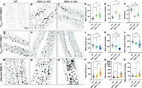 Effects Of NEKL 2 Or NEKL 3 Depletion On Endosomal Compartments In C