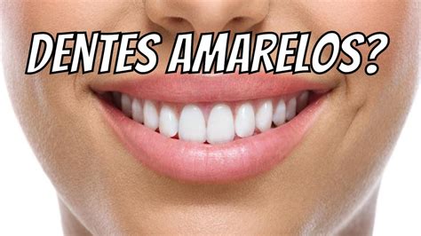 Conheça alguns alimentos que mancham os dentes YouTube