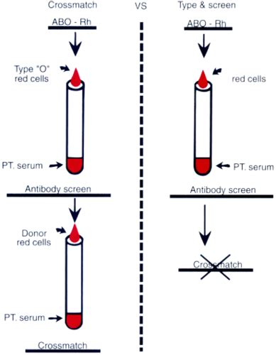 IV Fluids Blood And Post Operative Surgical Management Flashcards