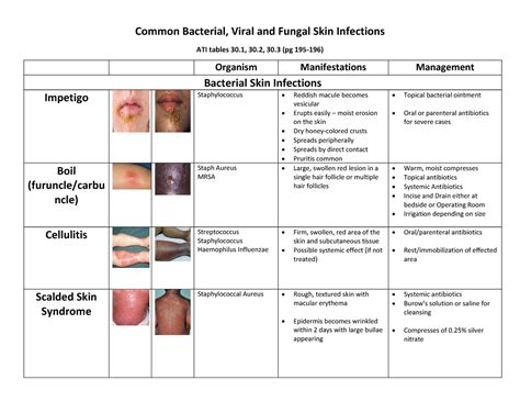 Skin Infections Info Sheet Common Bacterial Viral And Fungal Skin