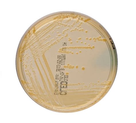 Thermo Scientific CLED Agar:Microbiological Media and Media Additives ...