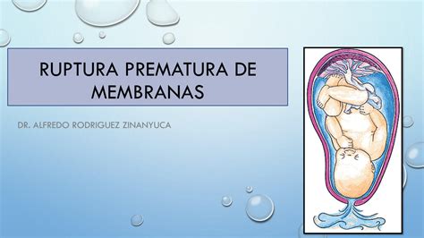 Solution Ruptura Prematura De Membranas Studypool