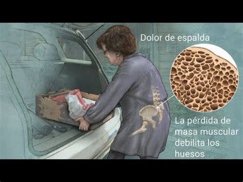 Osteoporosis Cuida Tus Huesos Con Fisioterapia Y Ejercicio Youtube