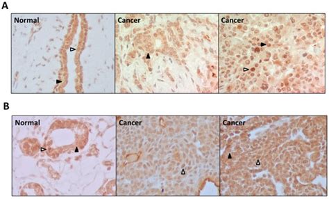 Cancers Free Full Text Novel Non Cyclooxygenase Inhibitory